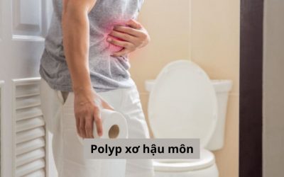 Điều trị polyp xơ hậu môn: Nên hay không nên phẫu thuật?