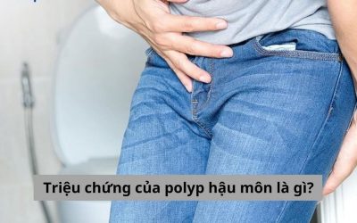 Triệu chứng của polyp hậu môn là gì? Nhận biết để kịp thời điều trị