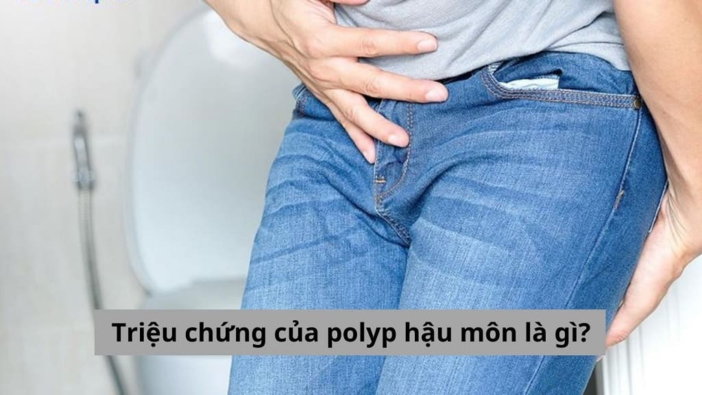 Triệu chứng của polyp hậu môn là gì