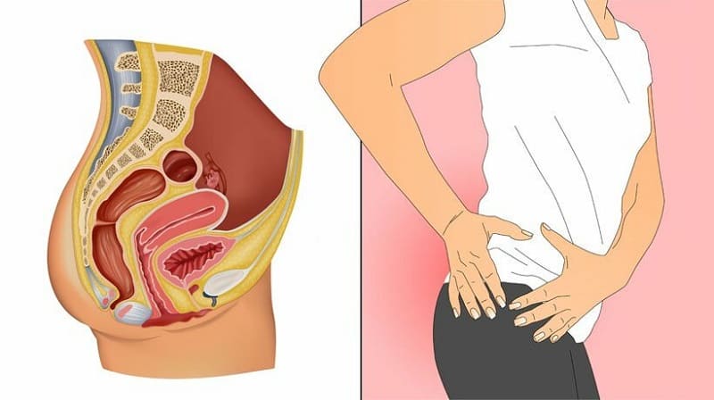 Tại sao cần cắt bỏ u lành tính ống hậu môn?