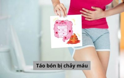 Táo bón bị chảy máu: Đừng chủ quan, nguy cơ bệnh lý nguy hiểm