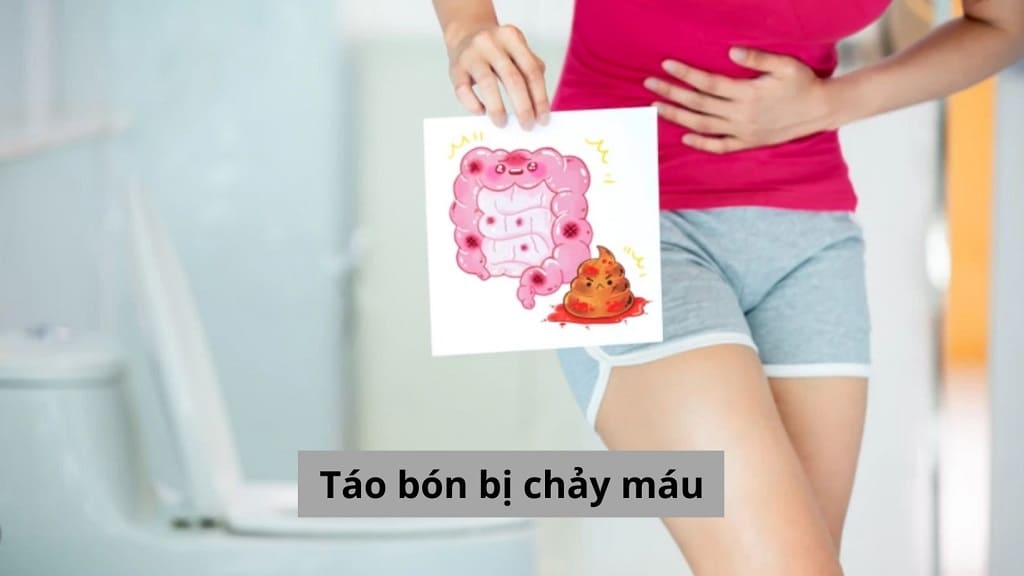 Táo bón bị chảy máu