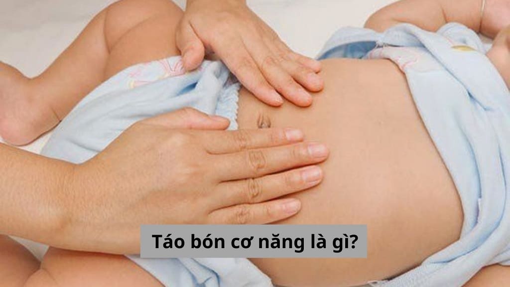 Táo bón cơ năng là gì