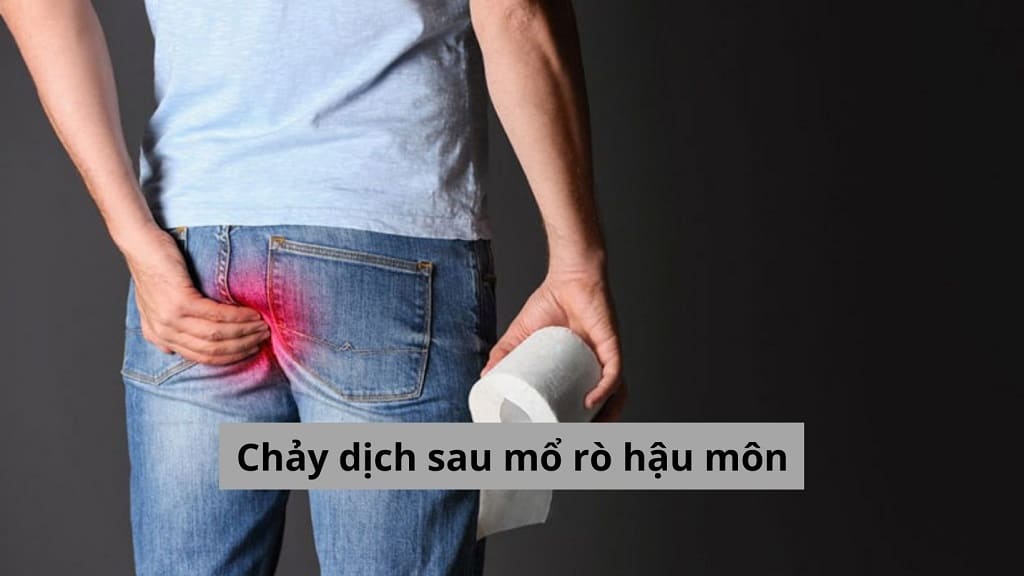 Chảy dịch sau mổ rò hậu môn