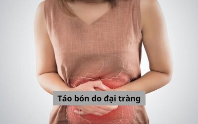 Táo bón do đại tràng cùng những thông tin bạn không nên bỏ lỡ