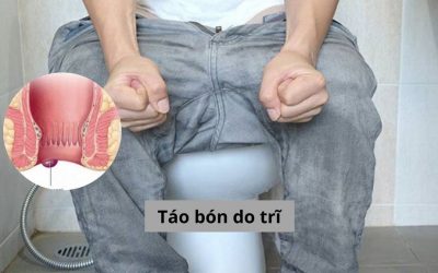 Táo bón do trĩ: Làm sao để khắc phục chứng bệnh này?