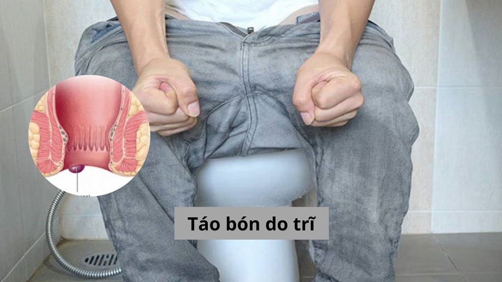 Táo bón do trĩ