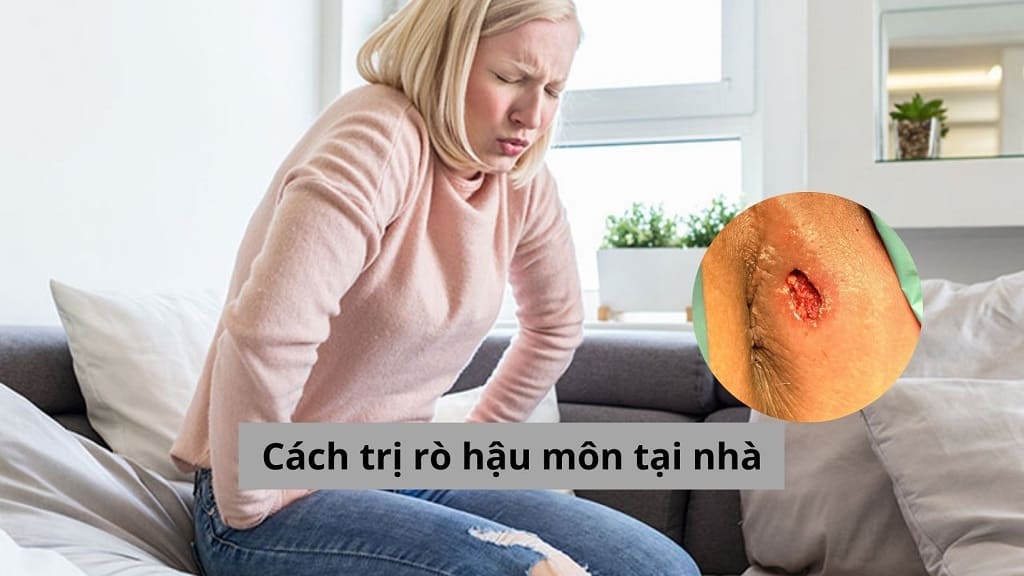 Cách trị rò hậu môn tại nhà