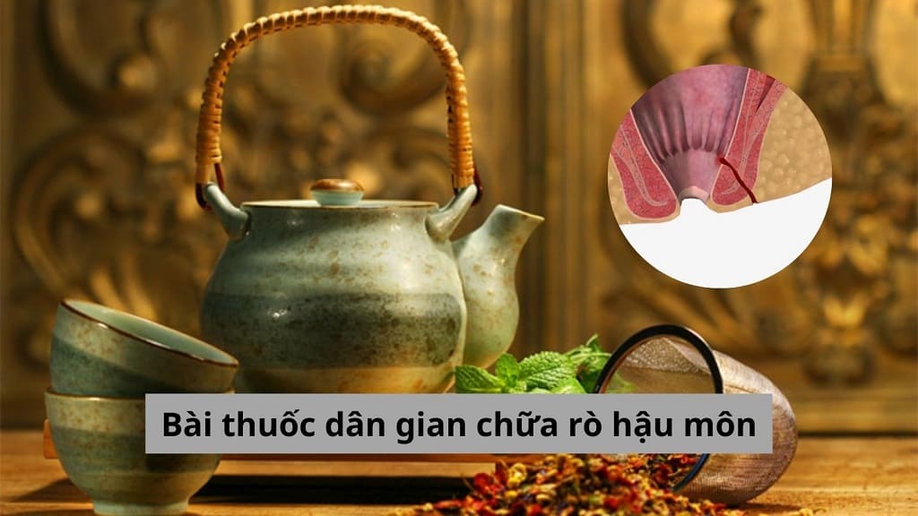 Bài thuốc dân gian chữa rò hậu môn