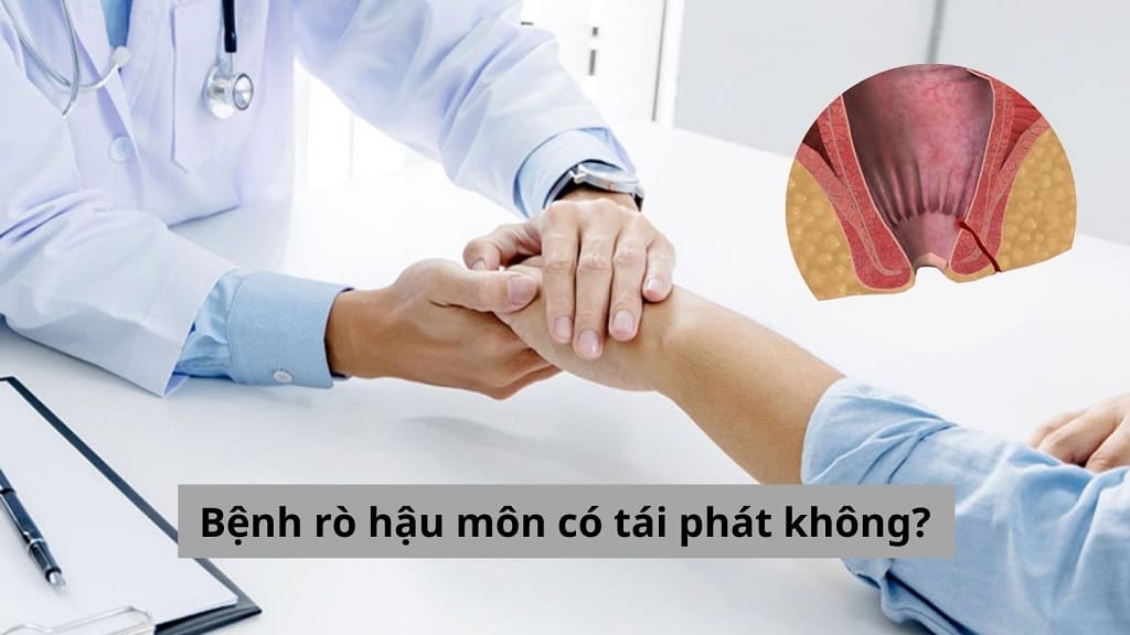 Bệnh rò hậu môn có tái phát không