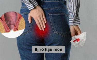 Tìm hiểu hiện tượng bị rò hậu môn và những vấn đề bạn cần chú ý