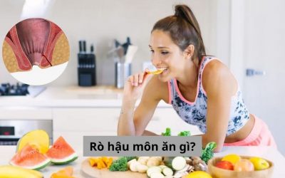 [Góc giải đáp] Bạn có biết rò hậu môn ăn gì thì tốt không?