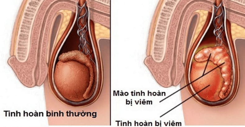 "Liệu