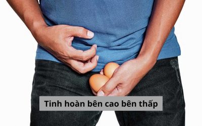 [Giải đáp băn khoăn] Tinh hoàn bên cao bên thấp lý do là vì đâu?