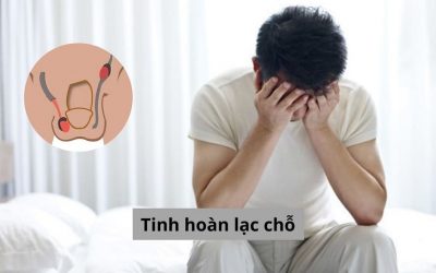 Tinh hoàn lạc chỗ là gì? Nguyên nhân và cách điều trị hiệu quả