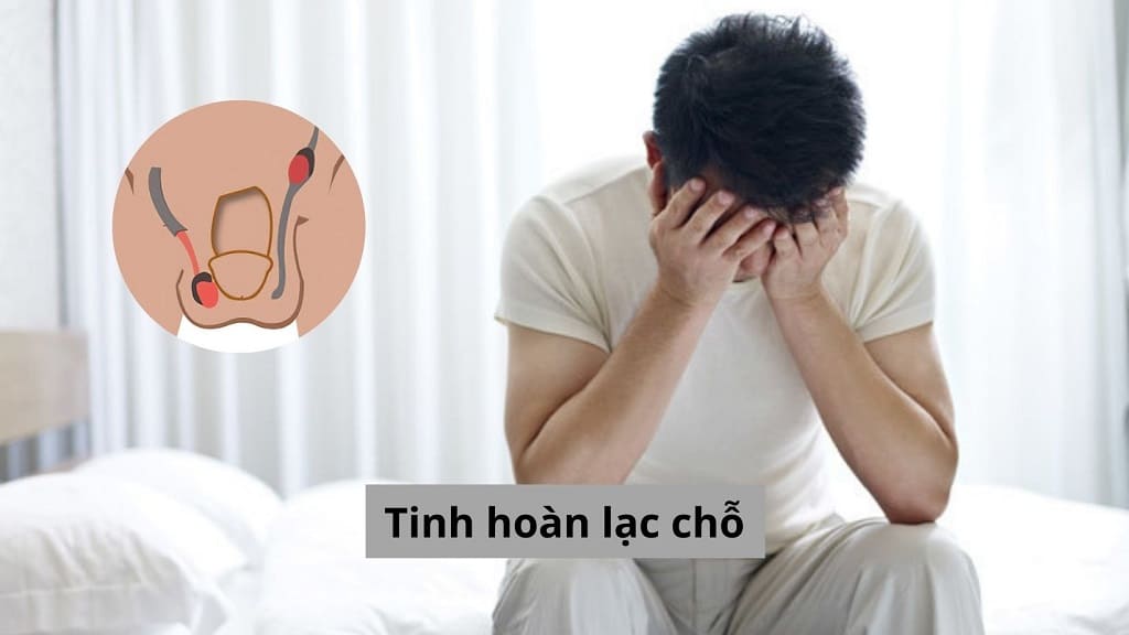 Tinh hoàn lạc chỗ