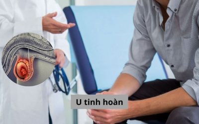 Cập nhật thông tin từ A – Z về bệnh lý u tinh hoàn