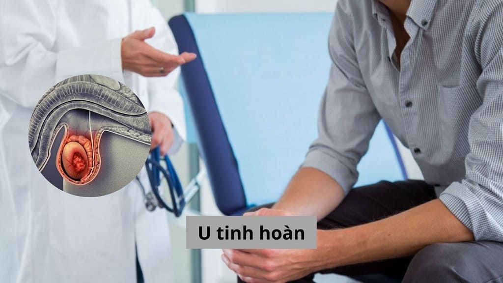 U tinh hoàn