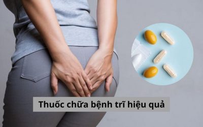 [CHI TIẾT] 5 loại thuốc chữa bệnh trĩ hiệu quả và phổ biến hiện nay 