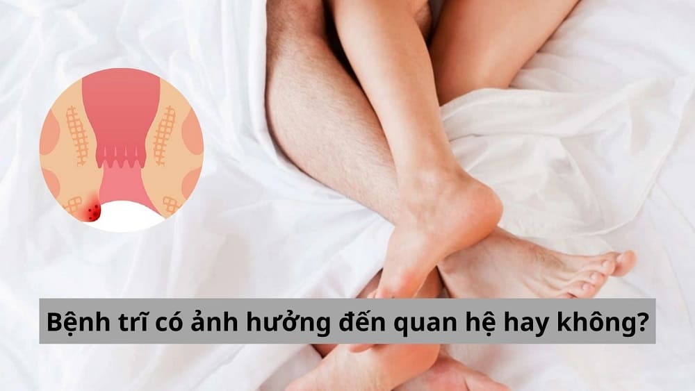 Bệnh trĩ có ảnh hưởng đến quan hệ hay không?