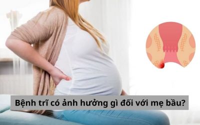 Bệnh trĩ có ảnh hưởng gì đối với mẹ bầu? – Trĩ khi mang thai