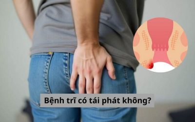 [Bác sĩ giải đáp] Bệnh trĩ có tái phát không? Điều trị như thế nào?