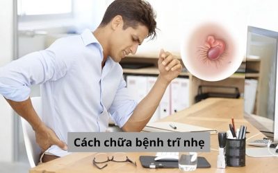 Cách chữa bệnh trĩ nhẹ – Bỏ túi các phương pháp hiệu quả
