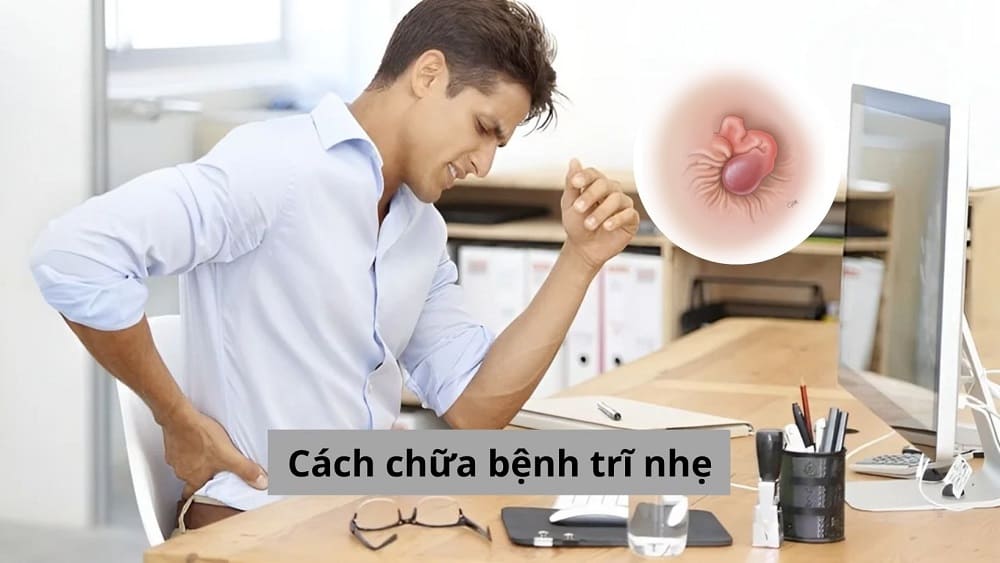 Cách chữa bệnh trĩ nhẹ