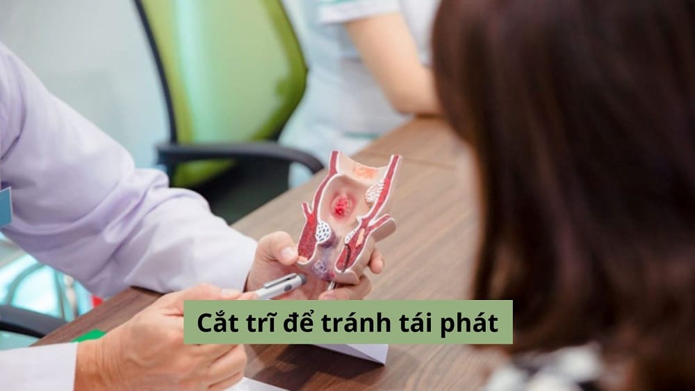 Cắt trĩ để tránh tái phát