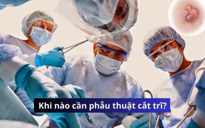 Dấu hiệu bệnh trĩ nhận biết như thế nào? Khi nào cần phẫu thuật cắt trĩ? 
