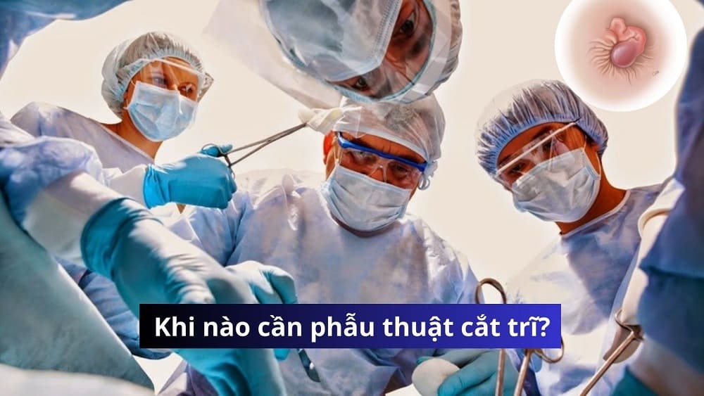 Khi nào cần phẫu thuật cắt trĩ?