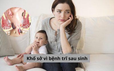 Khổ sở vì bệnh trĩ sau sinh phải làm sao? Nguyên nhân và cách điều trị