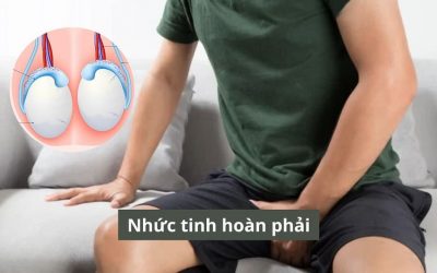 Nhức tinh hoàn phải: Nguyên nhân và phương pháp điều trị