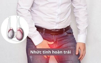 Nhức tinh hoàn trái và những hệ quả không mong muốn
