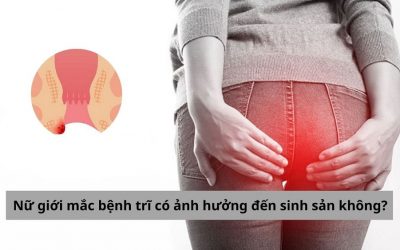 [Giải đáp] Nữ giới mắc bệnh trĩ có ảnh hưởng đến sinh sản không?