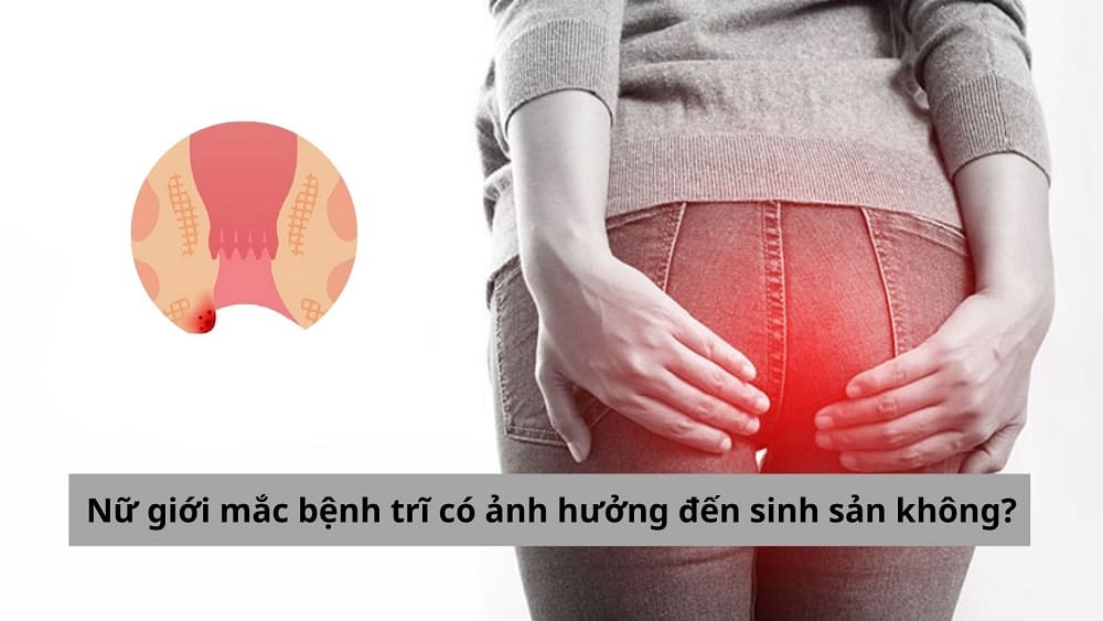 Nữ giới mắc bệnh trĩ có ảnh hưởng đến sinh sản không?