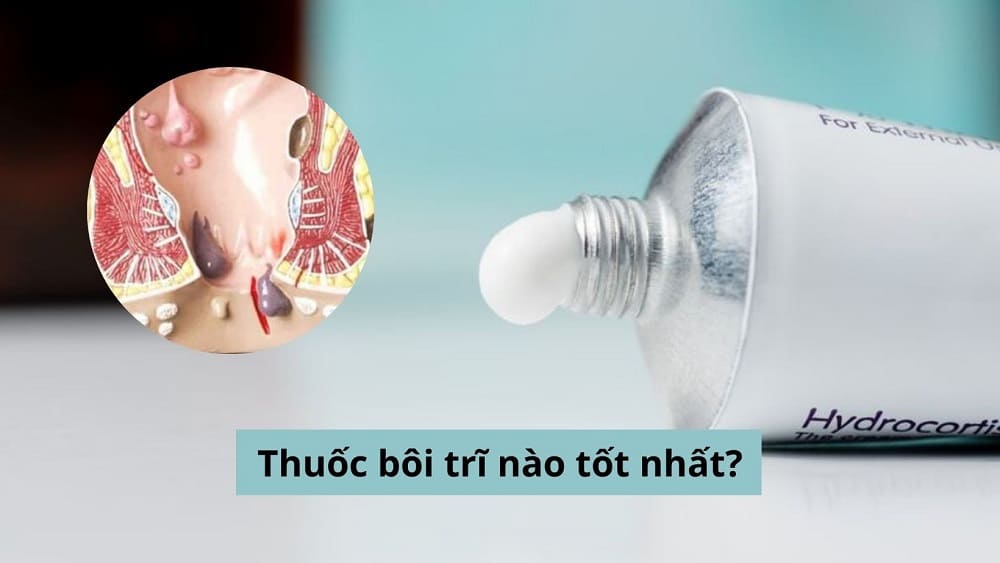 Thuốc bôi trĩ nào tốt nhất