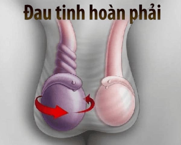 Xoắn tinh hoàn