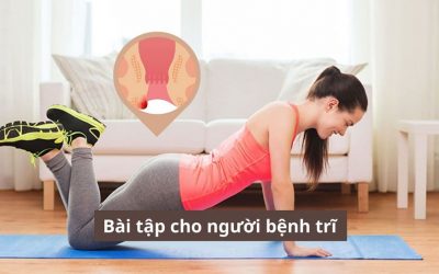 6 Bài tập cho người bệnh trĩ đơn giản và hiệu quả – ngay tại nhà!