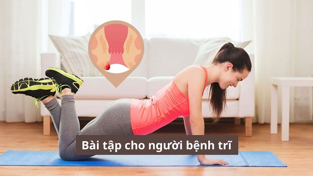 Bài tập cho người bệnh trĩ