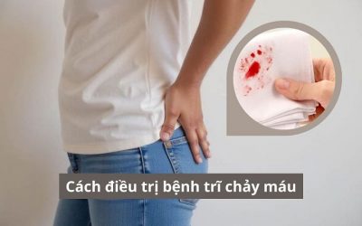 [Giải đáp] Đâu là cách điều trị bệnh trĩ chảy máu an toàn, hiệu quả?
