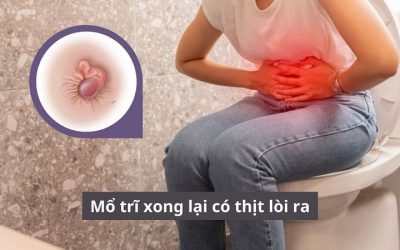 Mổ trĩ xong lại có thịt lòi ra cần khắc phục đúng cách như thế nào?