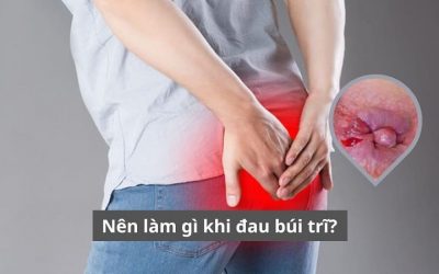 Bác sĩ tư vấn: Nên làm gì khi đau búi trĩ? Phương pháp nào hiệu quả?