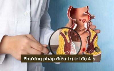 Bác sĩ chia sẻ sẻ các phương pháp điều trị trĩ độ 4 hiệu quả và an toàn