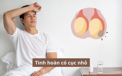 Tinh hoàn có cục nhỏ liệu có phải vấn đề đáng quan ngại?