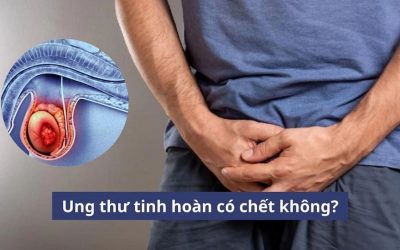 Ung thư tinh hoàn có chết không? Cùng lắng nghe bác sĩ giải đáp