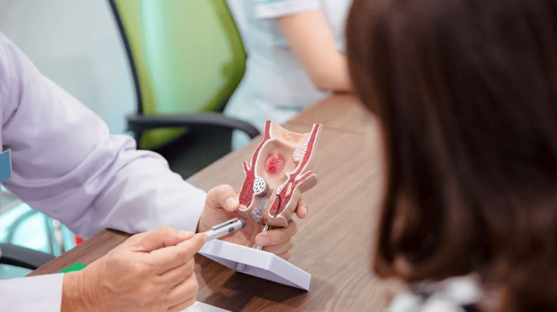 Bị bệnh trĩ giai đoạn đầu nên làm gì?