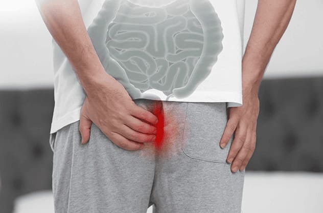Nguyên nhân gây ra đau hậu môn táo bón là gì?