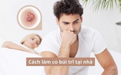 7 Cách làm co búi trĩ tại nhà đơn giản, an toàn có thể bạn chưa biết!