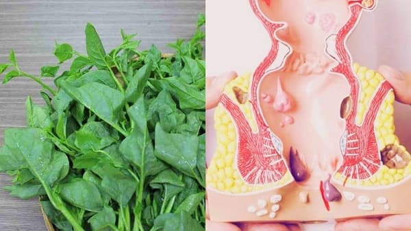 Ưu điểm và hạn chế khi sử dụng rau mồng tơi chữa bệnh trĩ